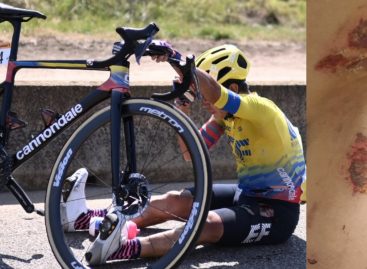 Las fuertes heridas que le dejó el Tour de Francia al antioqueño Sergio Andrés Higuita