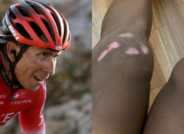 Nairo Quintana fue operado de las dos rodillas en Francia