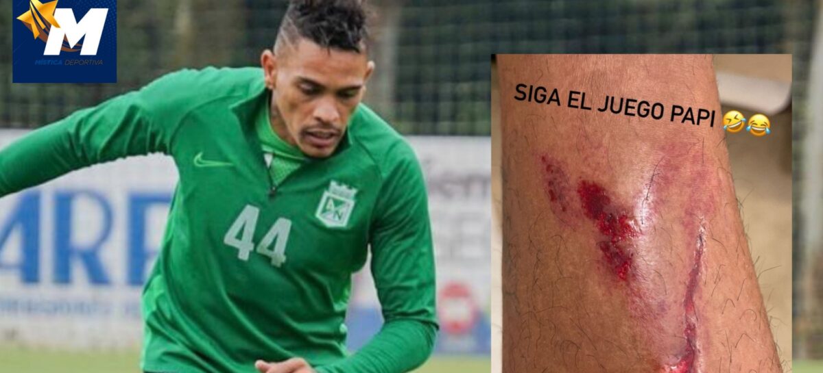 Jonatan Álvez mostró herida en el pie tras fuerte entrada de un jugador de La Equidad