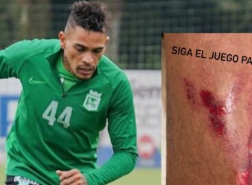 Jonatan Álvez mostró herida en el pie tras fuerte entrada de un jugador de La Equidad