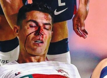 ¡Susto con CR7! El portugués sufrió un fuerte golpe en el partido entre Portugal y República Checa