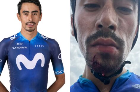 El ciclista colombiano, Iván Sosa, fue agredido con la cacha de un arma de fuego