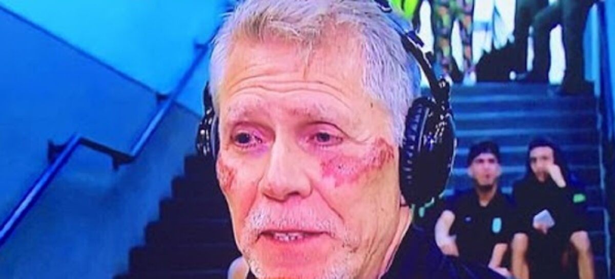 ¿Qué le pasó a Paulo Autuori en la cara? Hinchas de Atlético Nacional están preocupados por la salud del DT