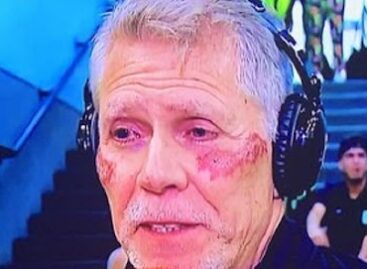 ¿Qué le pasó a Paulo Autuori en la cara? Hinchas de Atlético Nacional están preocupados por la salud del DT